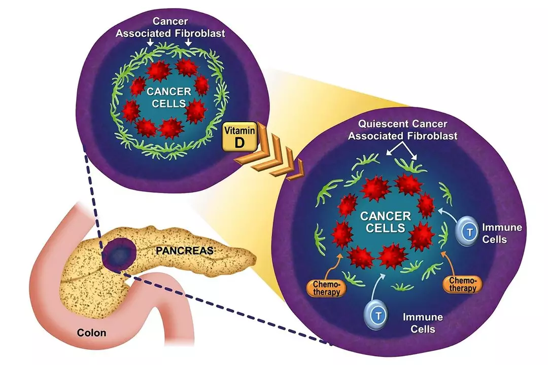 Alfacalcidol and its Potential in Cancer Prevention