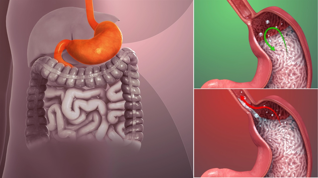 Erosive Esophagitis and GERD: How They're Related and What to Do